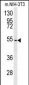 CCZ1 Antibody (Center)